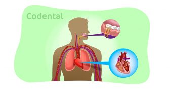 Endocardite bacteriana na odontologia: guia completo