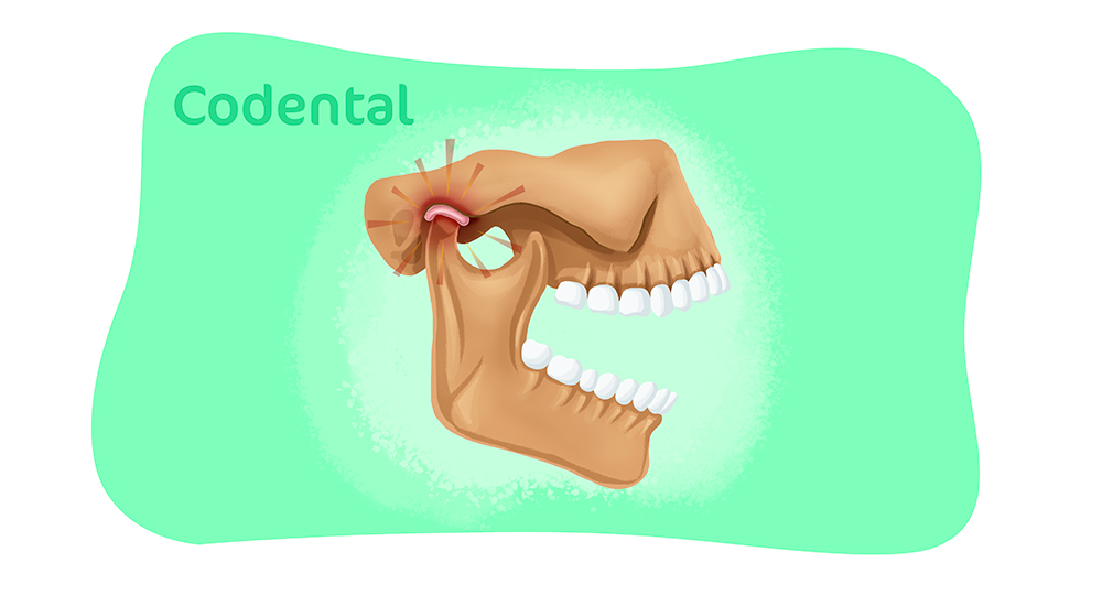 CB Odonto - Sentir o maxilar estalando ou a mandíbula travando não