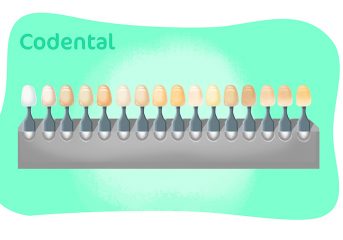 Cores de resina para dentes