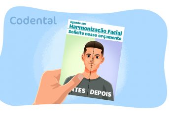 Harmonização facial valor