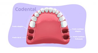 Conheça todos os tipos de sutura odontológica