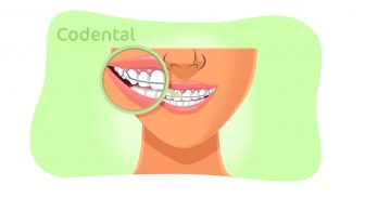 Contenção Ortodôntica: entenda sua importância