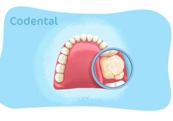 Infiltração no dente