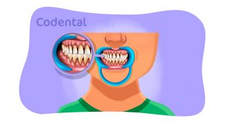 Perda óssea dentária: entenda o problema