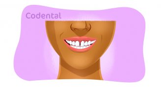 Diastema: um guia completo sobre o problema