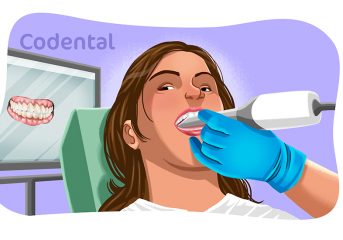 escaneamento intraoral