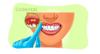 Abscesso no dente: causa, sintoma e muito mais