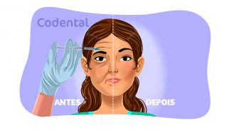 Botox na odontologia: aplicação, benefícios e muito mais