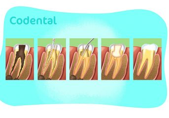 Endodontia