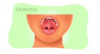 Feridas no céu da boca: aprenda tudo sobre