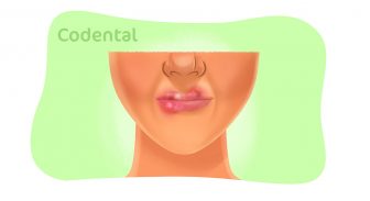 Herpes labial: causas, sintomas e tratamento