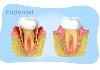 Periodontia