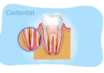 Canal no dente