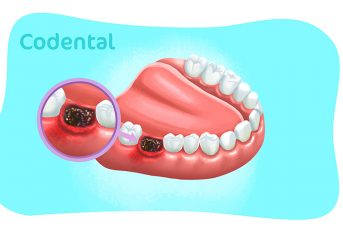 alveolite