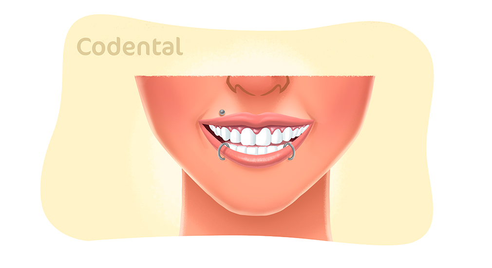 Piercing na boca: quais são os riscos e como prevenir infecções