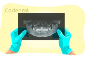 radiologia na odontologia