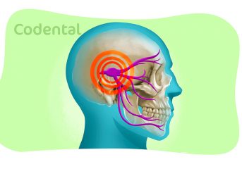 neuralgia do trigemeo