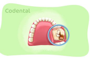 Dente furado