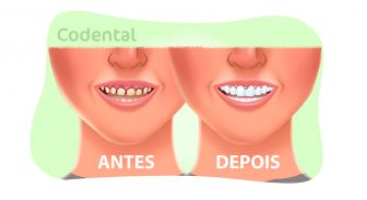 Estética dental: confira tudo sobre o assunto!
