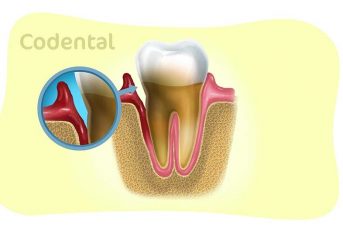 bolsa periodontal