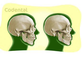 bucomaxilofacial