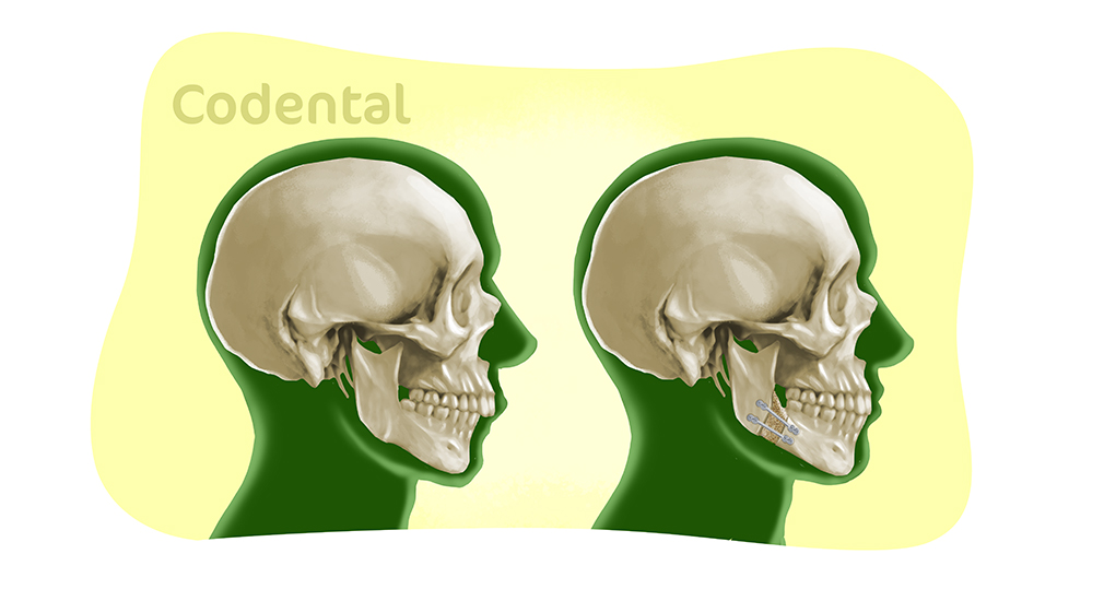 bucomaxilofacial