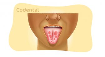 Manchas na língua: tudo que você precisa saber!
