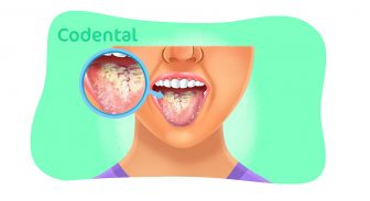 Candidíase oral: um guia completo sobre o assunto!