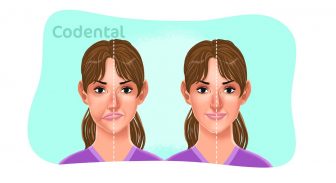 assimetria facial