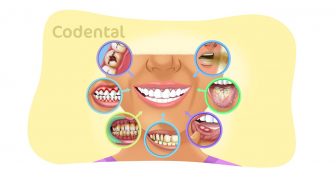 Patologia Bucal: principais tipos e como prevenir e muito mais!