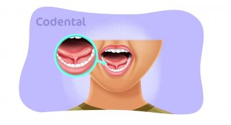 Anquiloglossia: tudo que você precisa saber sobre!