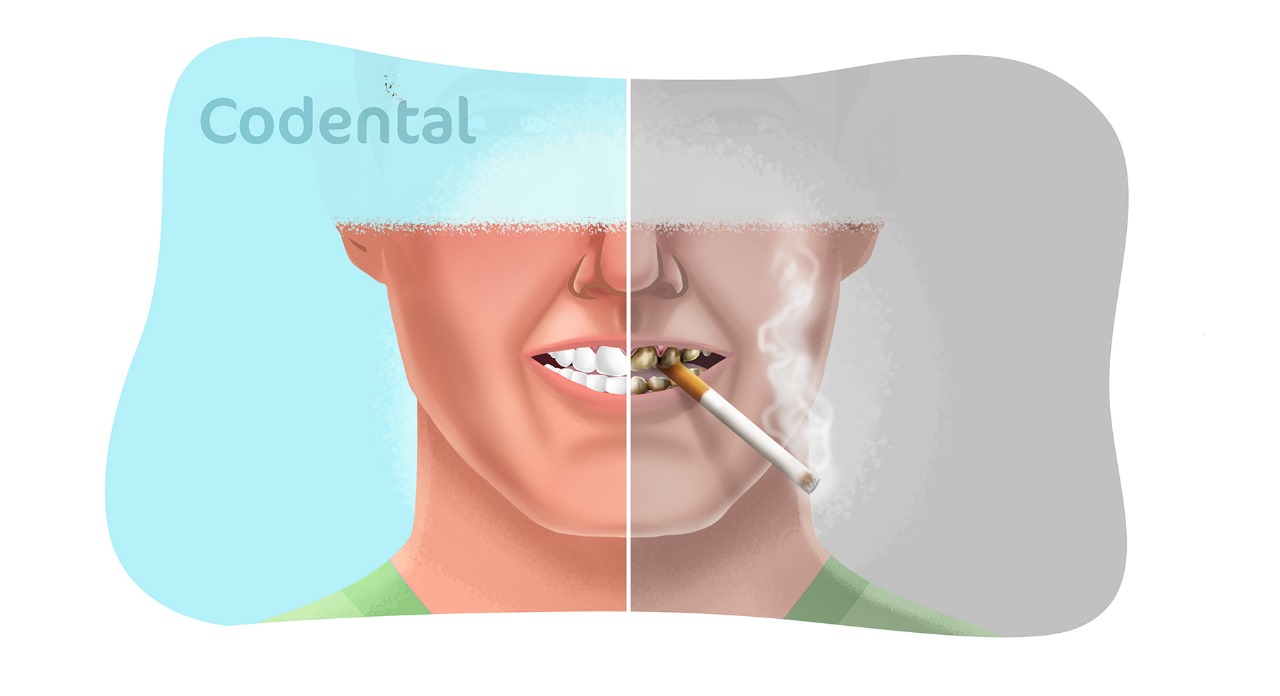 Cigarro e saúde bucal