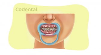 dentinogenese imperfeita