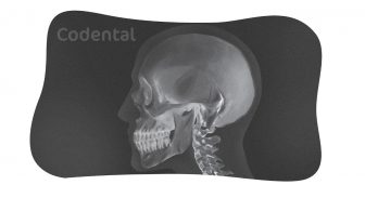 Radiografia cefalométrica