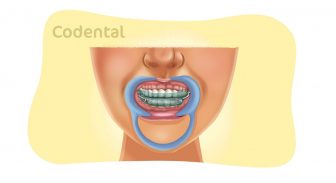 aparelho intra-oral